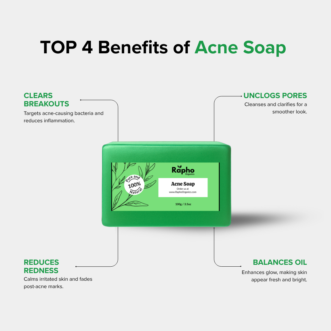 Acne Soap