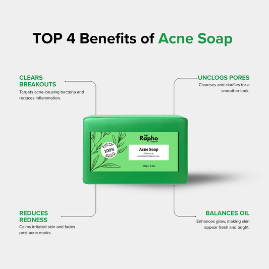Acne Soap